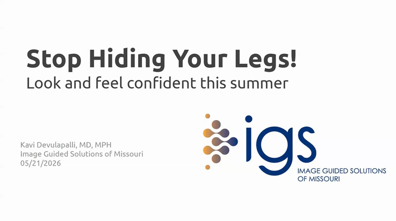 Varicose veins